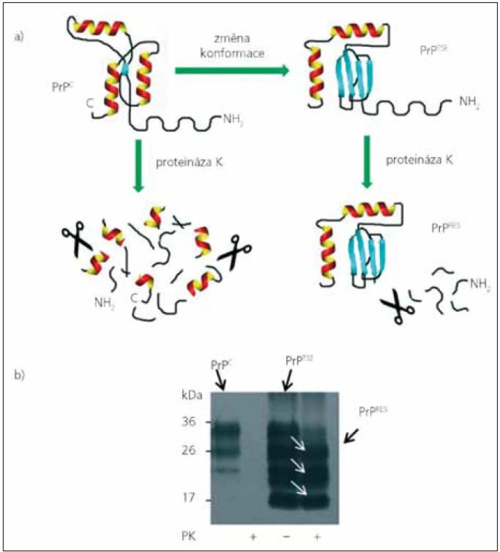 Detekce patologického prionového proteinu na základě jeho odolnosti vůči proteolytickému štěpení.
Obr. 1a) Patologický prionový protein (PrP<sup>TSE</sup>) se od normálního buněčného prionového proteinu (PrP<sup>C</sup>) liší konfomací s vysokým obsahem struktur β skládaného listu, která ho činí odolným vůči proteolýze. Po inkubaci s proteinázou K dochází ke kompletnímu rozštěpení PrP<sup>C</sup>, zatímco u PrP<sup>TSE</sup> dojde odštěpení pouze nestrukturovaného fragmentu z N konce a zbytek molekuly je vůči štěpení rezistentní (PrP<sup>RES</sup>).
Obr. 1b) Detekce PrP<sup>C</sup> a PrP<sup>TSE</sup> v myším mozkovém homogenátu pomocí western blotu. Bez inkubace s proteinázou K (PK) detekujeme v normálním myším mozku tři izoformy PrP<sup>C</sup> (neglykosylovanou, monoglykosylovanou a diglykosylovanou), proteolýza pak vede ke kompletnímu vymizení signálu. Proteolýza PrP<sup>TSE</sup> v homogenátu myši infikované RML kmenem „scrapie“, vede pouze k charakteristickému zvýšení elektroforetické pohyblivosti jednotlivých izoforem PrP<sup>RES</sup> (bílé šipky), které je způsobené snížením molekulové hmotnosti izoforem po odštěpení jejich N terminálů.