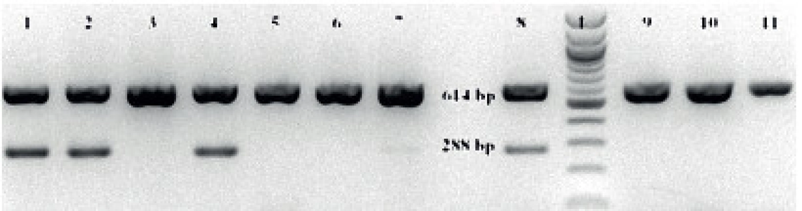 Výsledek gelové elektroforézy produktů PCR
Fig 2. The result of gel electrophoresis of PCR products
