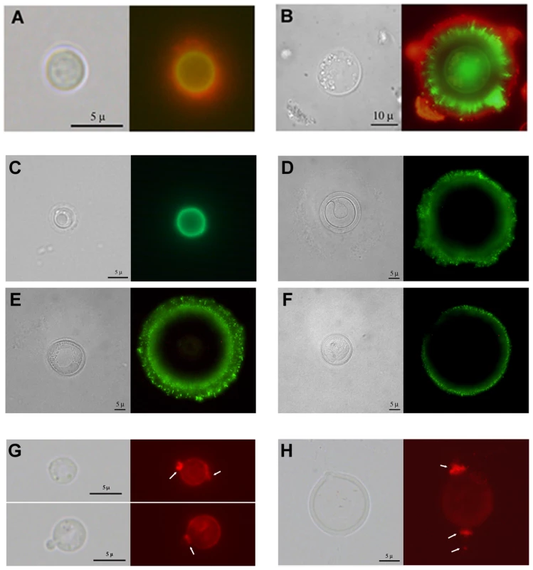 Differences in capsular structure between regular and giant cells.