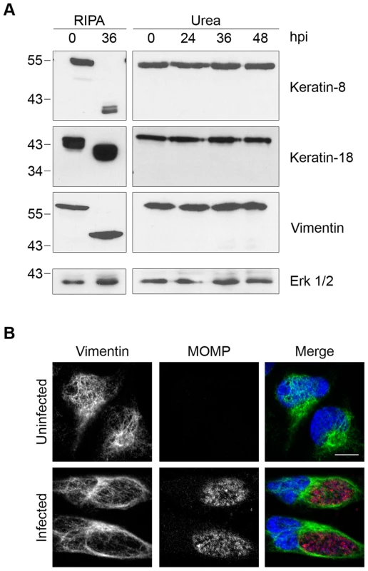 Cleavage of intermediate filaments in <i>Chlamydia</i>-infected cells is also dependent on cell processing.
