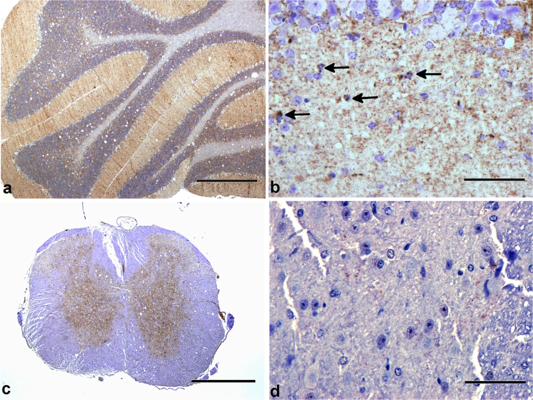 PrP-d accumulation in CNS.