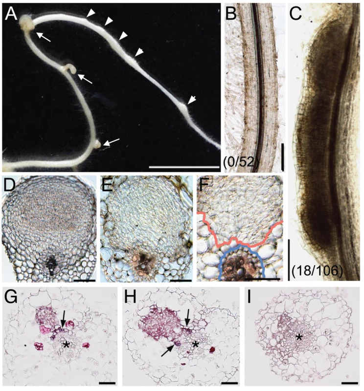 <i>NIN</i> overexpression induces cortical cell division.