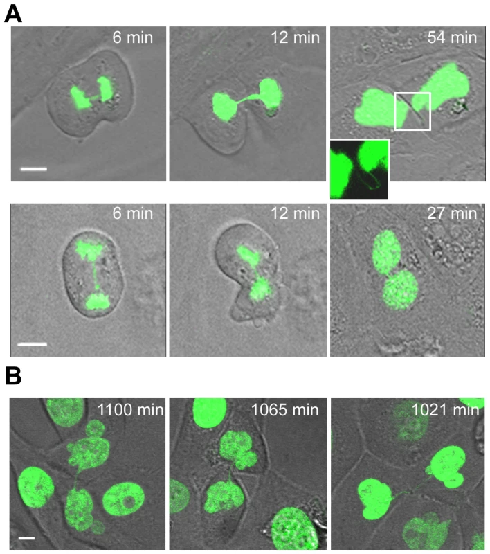 Unbroken anaphase bridges interfere with abscission in HMECs and HMEC-hTERT cells.