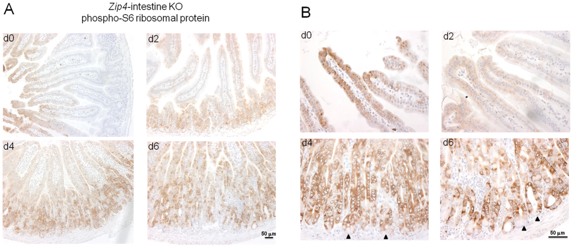 IHC detection of phosphorylated S6 ribosomal protein, as a read out for mTOR1 activity, reveals a loss of villus staining followed by increased staining of crypts after intestine-specific deletion of <i>Zip4</i>.