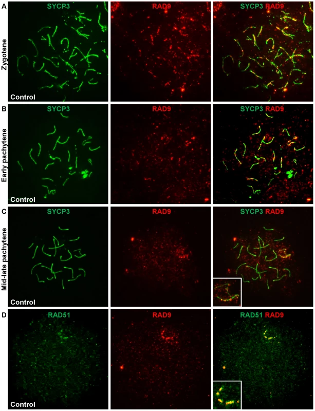 RAD9 localizes to meiotic chromosomes during early prophase I and colocalizes with a subset of RAD51 foci.