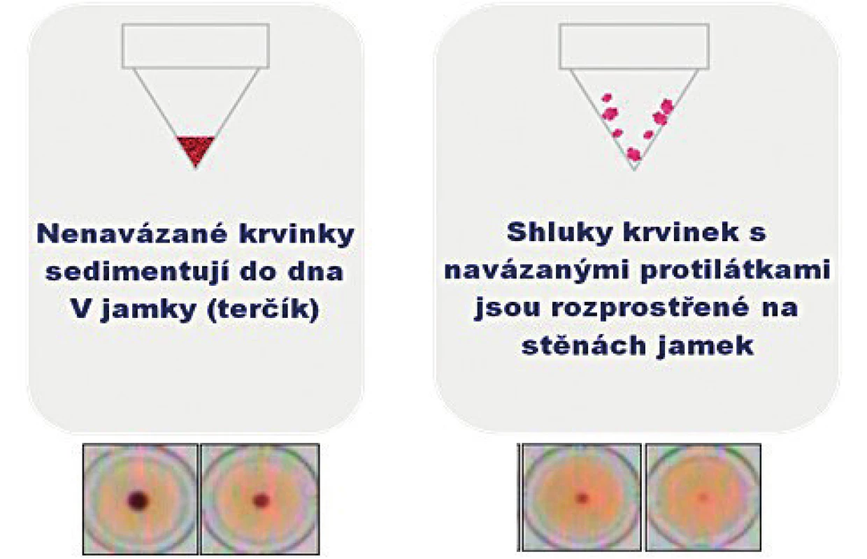 Znázornění negativního a pozitivního výsledku testu TPHA Screen<sup>TM</sup>