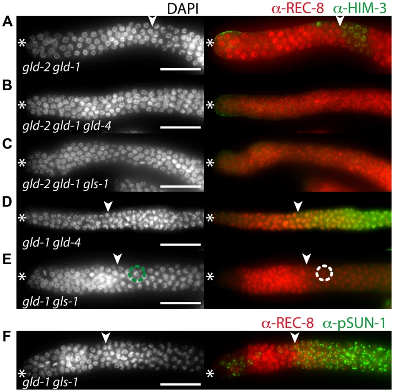 <i>gld-4</i> and <i>gls-1</i> promote onset of differentiation in parallel to <i>gld-2</i> and <i>gld-1</i>.