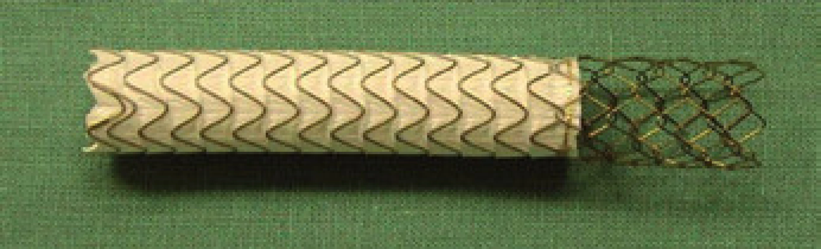 Dedikovaný ePTFE potahovaný stent Viatorr (W. L. Gore &amp; Associates).
Fig. 7. Dedicated ePTFE coated Viatorr stent (W. L. Gore &amp; Associates).