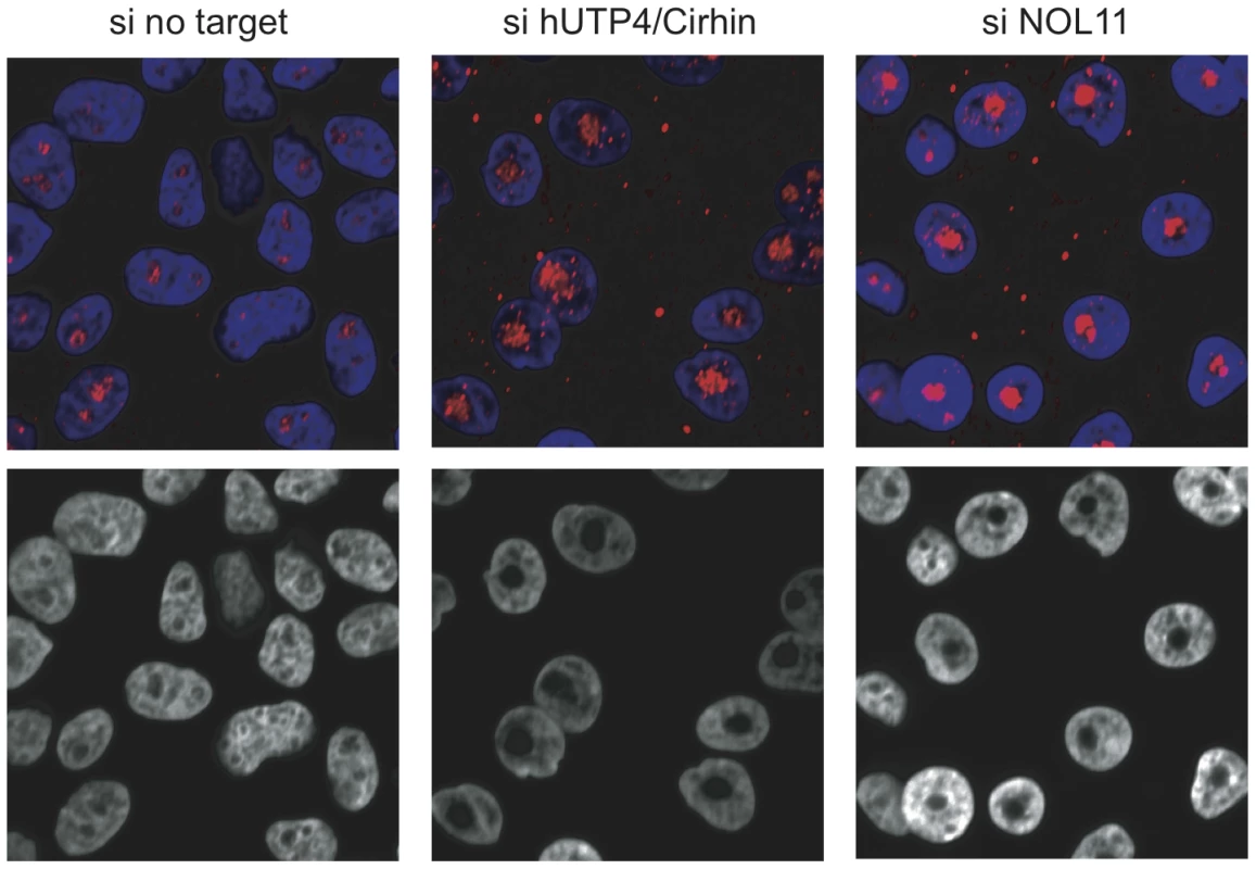 Loss of NOL11 causes abnormal nucleolar morphology.