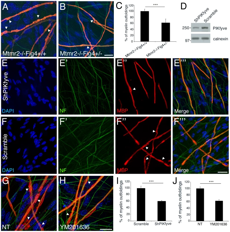 A rebalance of PtdIns(3,5)<i>P</i><sub>2</sub> rescues <i>Mtmr2</i>-null myelin outfoldings <i>in vitro</i>.