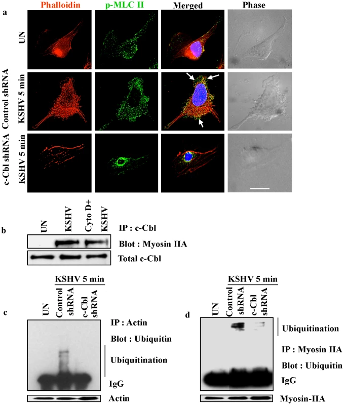 Myosin II associates with actin in KSHV induced blebs.