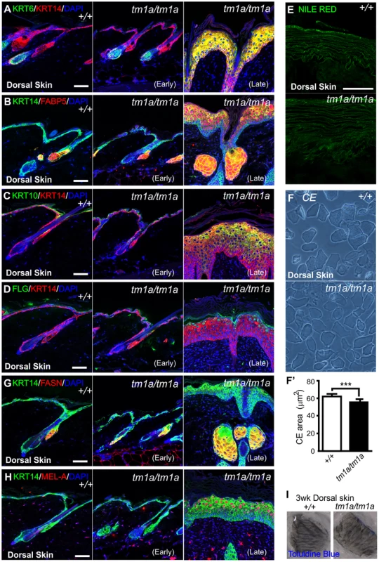 Biochemical analysis of <i>Krt76</i> disrupted skin.