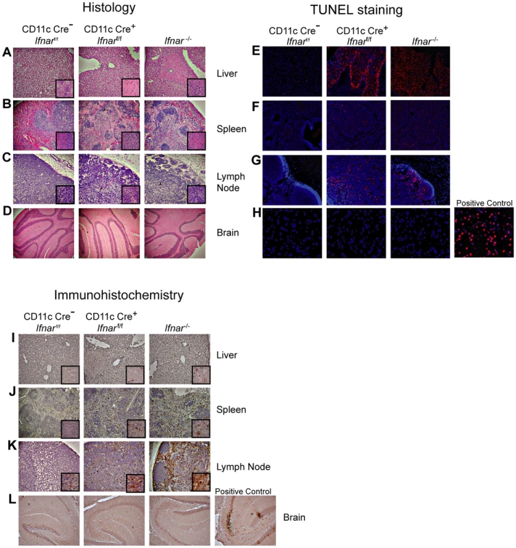 Tissue analysis of WNV-infected CD11c Cre<sup>+</sup> <i>Ifnar</i><sup>f/f</sup> mice.