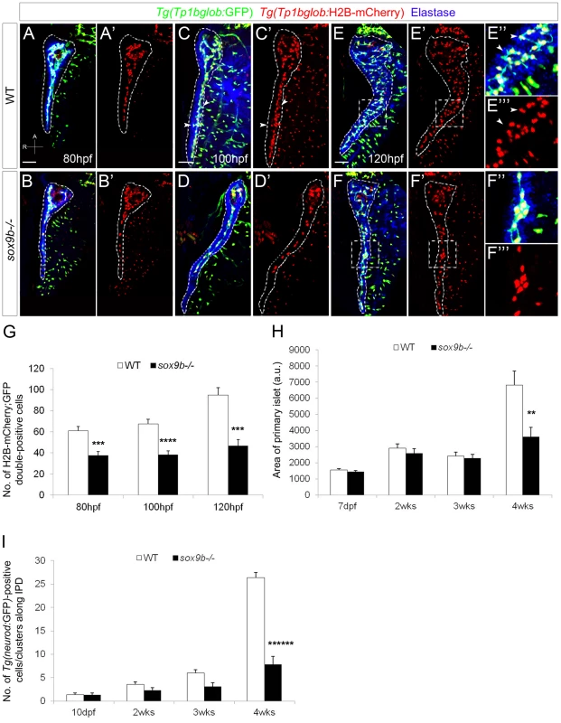 <i>sox9b</i> mutant larvae fail to form a complex intrapancreatic ductal network.