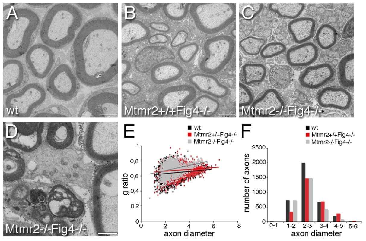 Hypomyelination in <i>Mtmr2</i>+/+<i>Fig4</i>−/− and <i>Mtmr2</i>−/−<i>Fig4</i>−/− sciatic nerves.