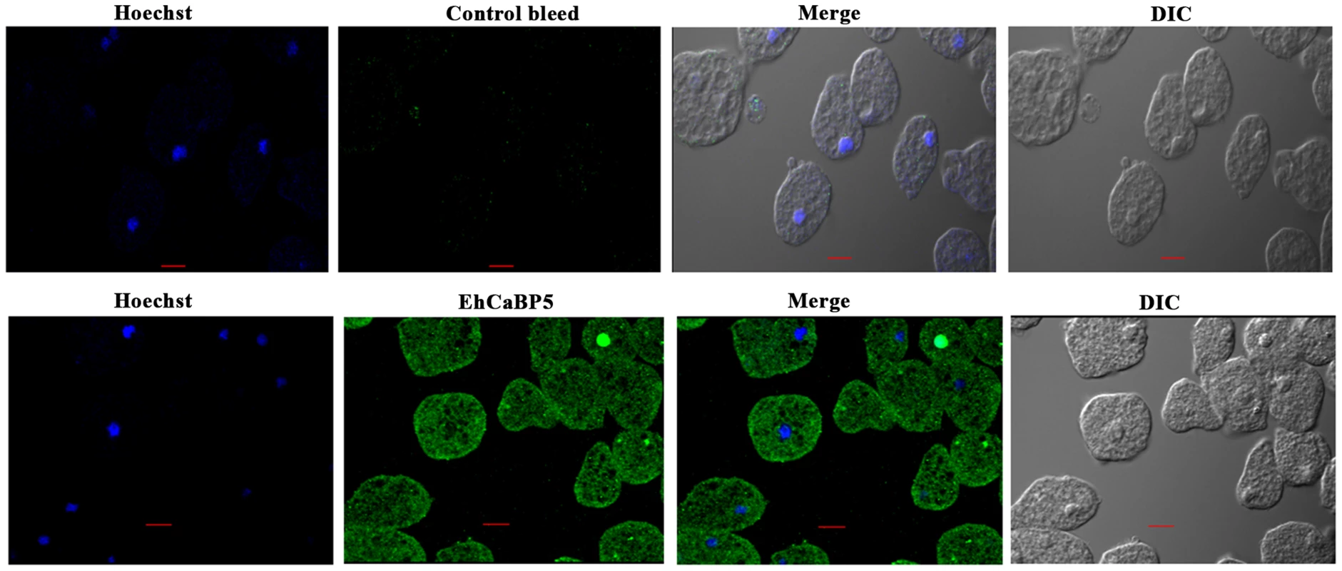 Immunolocalization of EhCaBP5 in <i>E. histolytica</i>.