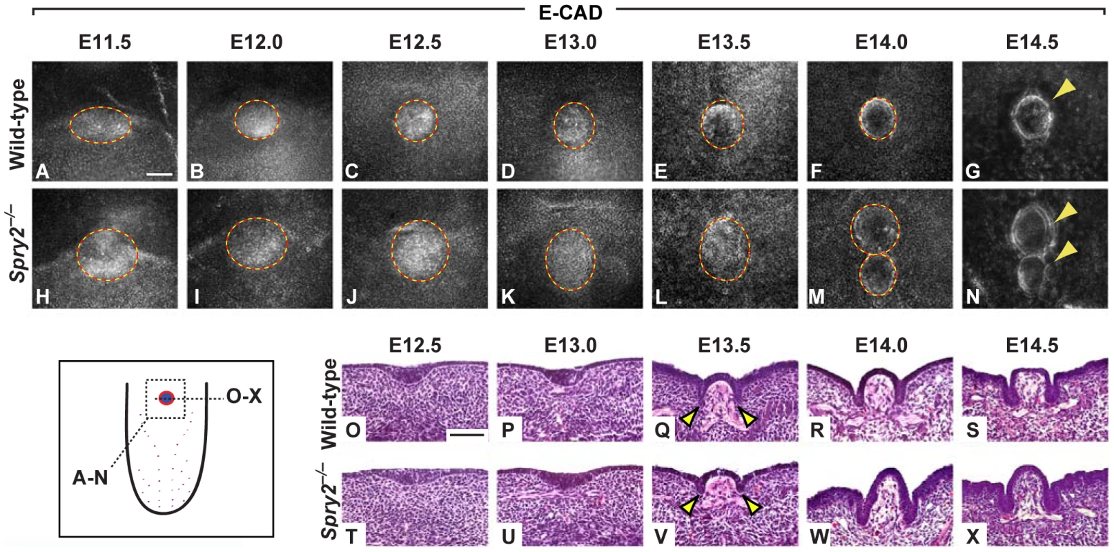 Development of the CVP in wild-type and <i>Spry2<sup>−/−</sup></i> mice.