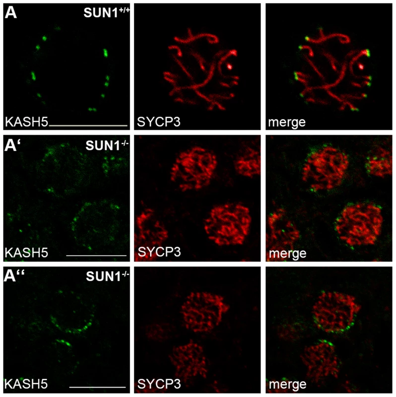 KASH5 localization in SUN1 deficient males.