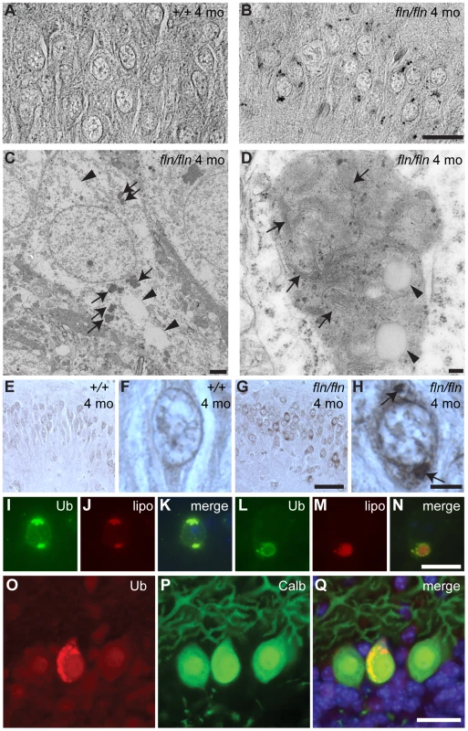 Lipofuscin and ubquitylated protein accumulation in CerS1-deficient neurons.
