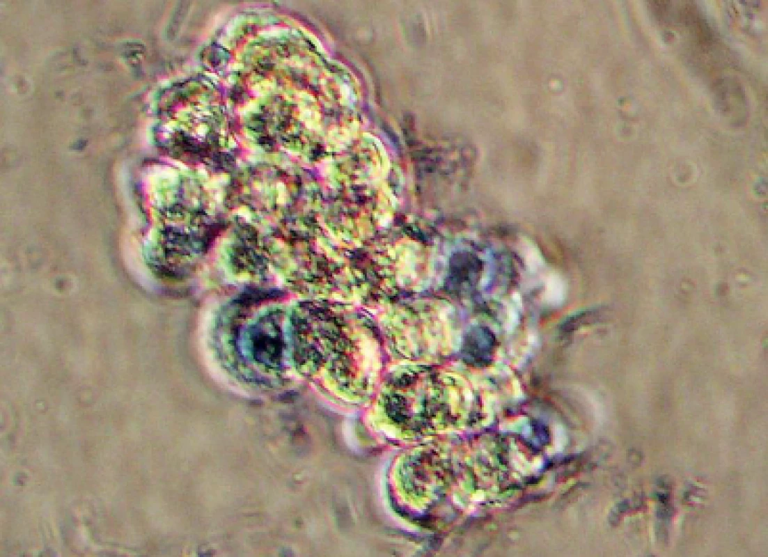 Izolované hepatocyty, mikrofotografie