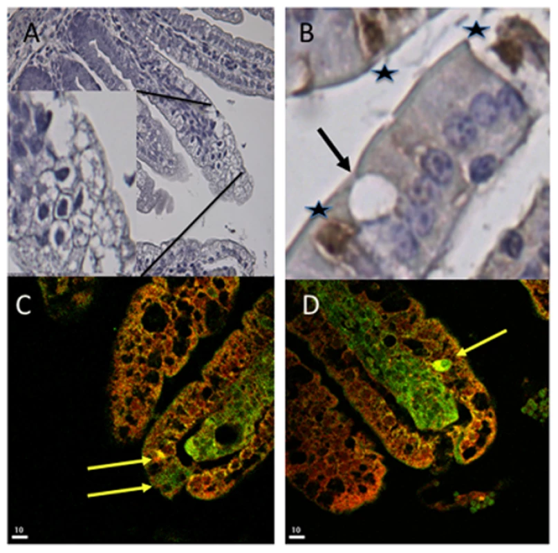 Co-localization of rotavirus and 5-HT in EC tumor cells.