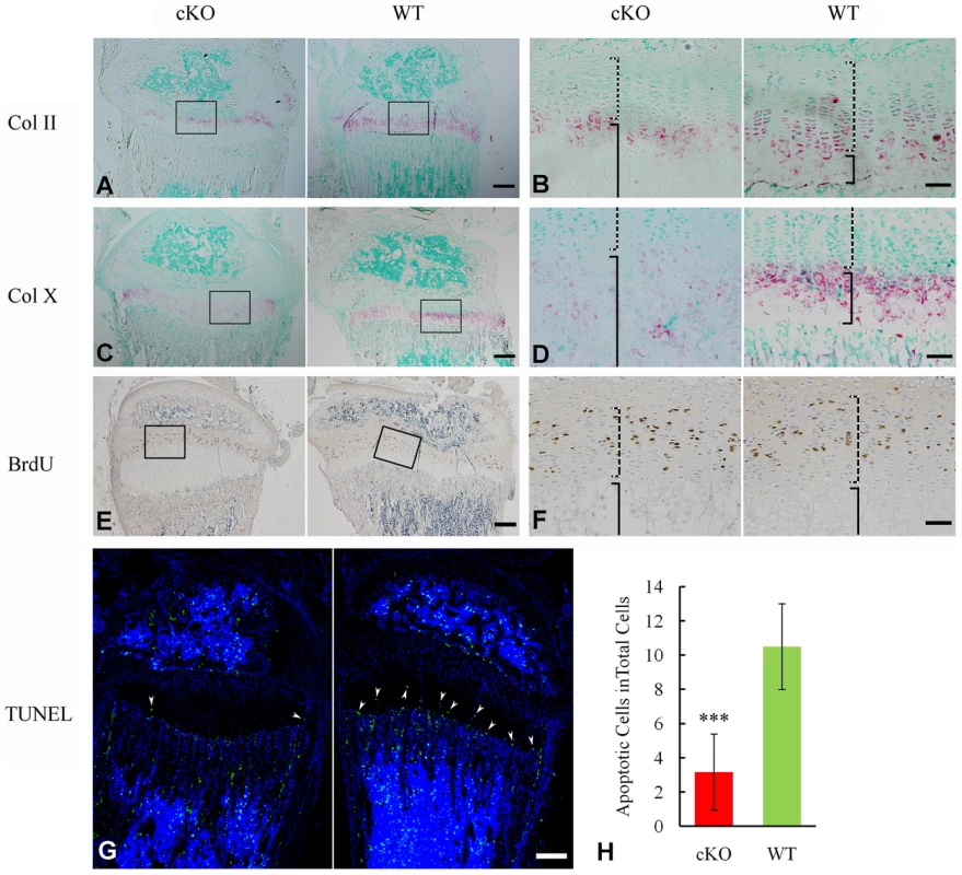 Growth plate defects in the 3-week-old <i>Sox2-Cre-Fam20c</i>-cKO mice.