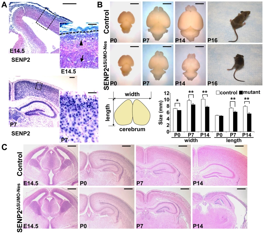 Disruption of SENP2 in the neural progenitors causes neurodegeneration.