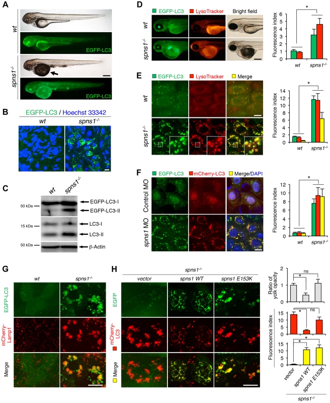 Aberrant autophagosome and autolysosome formation in <i>spns1</i>-mutant zebrafish.