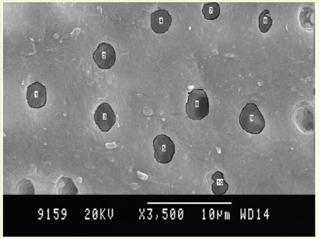 Fluorosed diseased specimens.