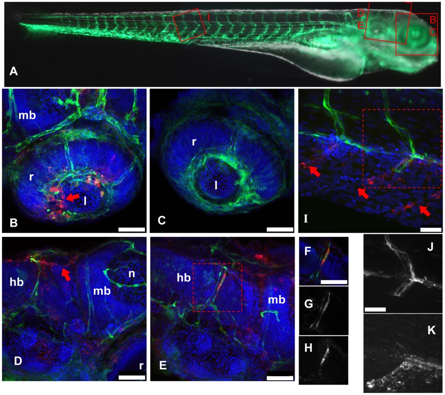 IHNV infects and disrupts blood vessels.