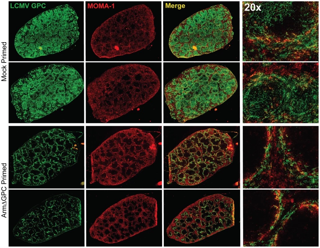 Differential localization of viral antigen in spleens of primed and mock primed Cl13 infected mice.