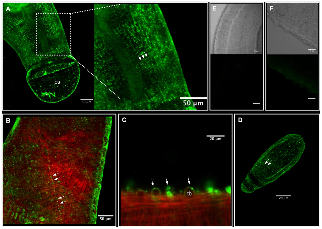 Immunolocalization of SmACC-1 and SmACC-2 in <i>Schistosoma mansoni</i>.