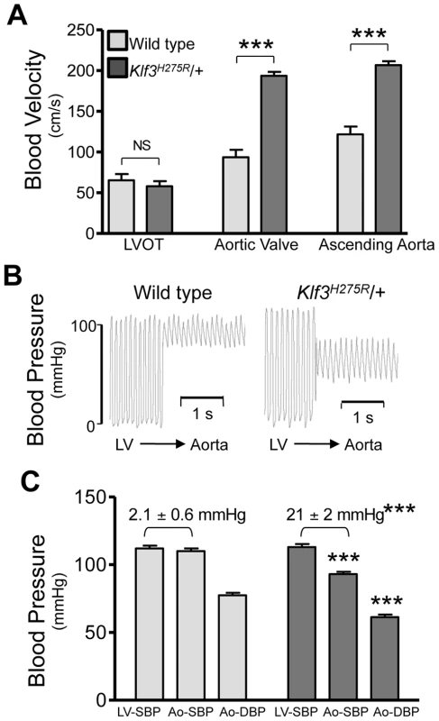Hemodynamic evidence for aortic valvular stenosis in <i>Klf3<sup>H275R</sup></i>/+ mice.