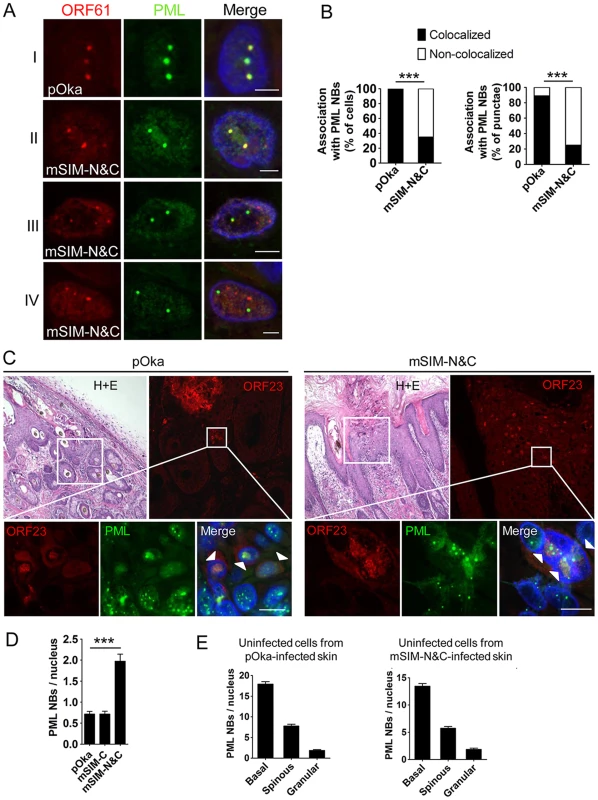 ORF61 SIMs are required for ORF61 association with and dispersal of PML NBs in skin cells <i>in vivo</i>.