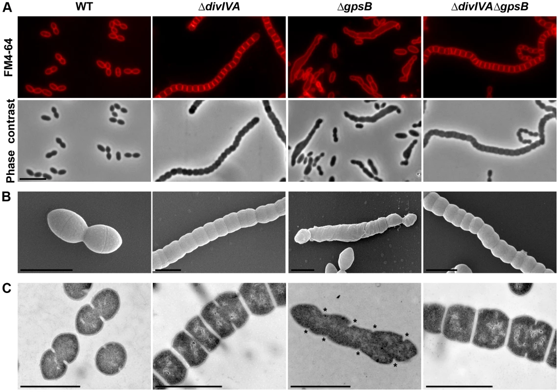 Morphology of WT, Δ<i>divIVA</i>, Δ<i>gpsB</i> and Δ<i>divIVA</i>Δ<i>gpsB</i> cells.