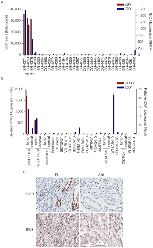 High levels of IDO1 in high EBV positive gastric carcinomas.