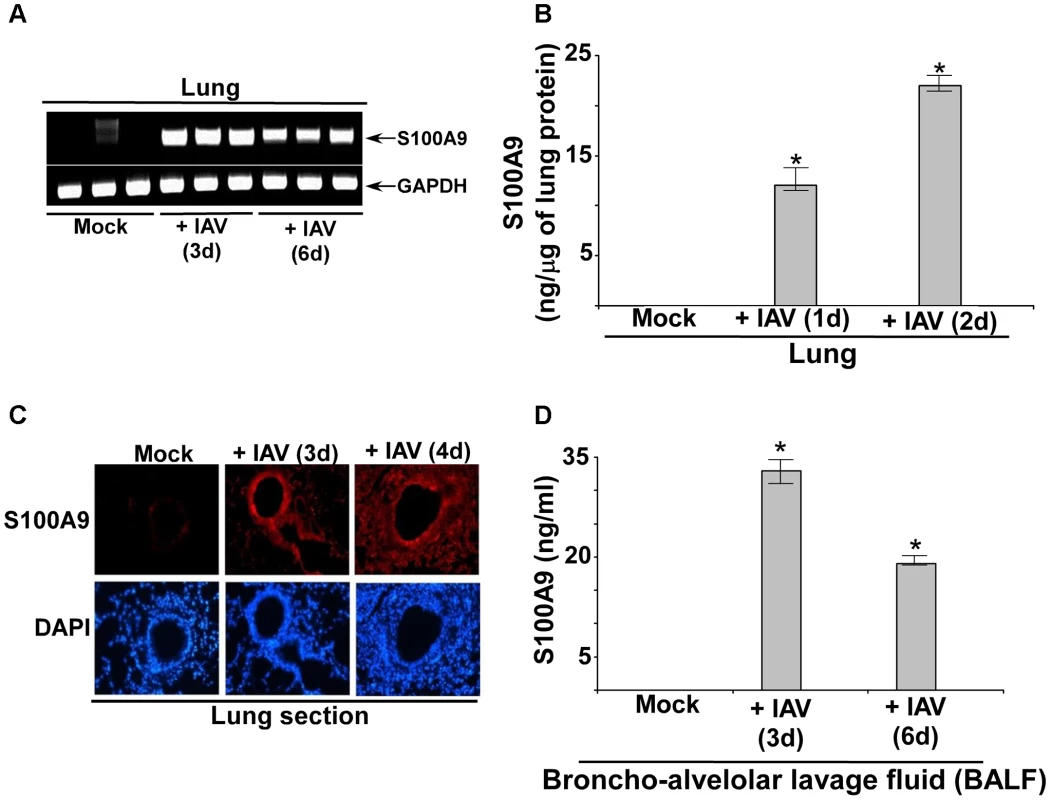 S100A9 expression and production in the IAV infected respiratory tract.
