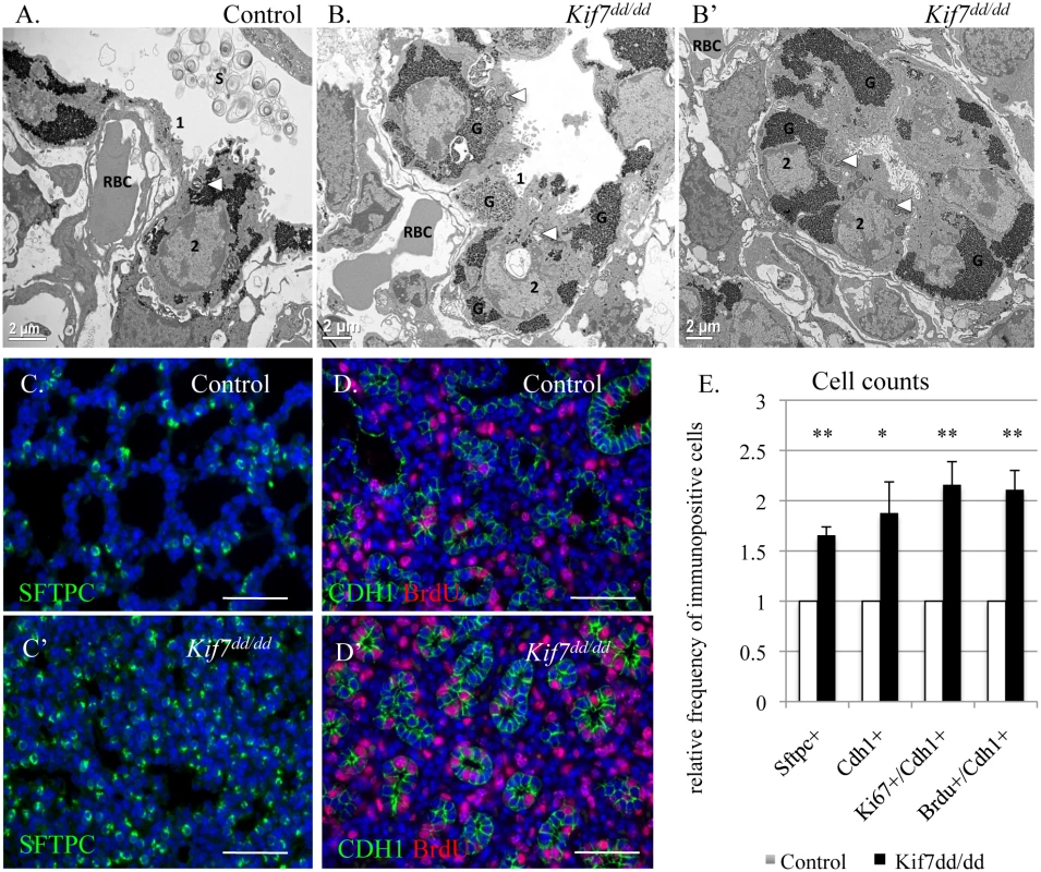 KIF7 is a negative regulator of cell proliferation within the respiratory epithelium.