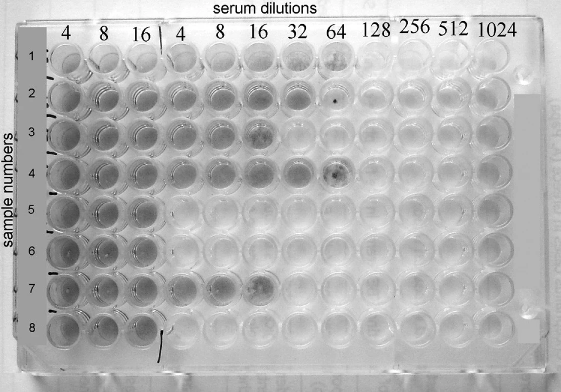 Rows 1, 2, 3, 4. and 7 show positive results with VN titers 64, 32, 16, 64 and 16 respectively, whereas rows 5, 6 and 8 reveal negative results.