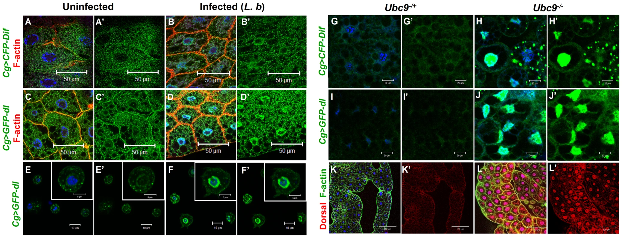 Nuclear localization of Dorsal and Dif in inflammation.
