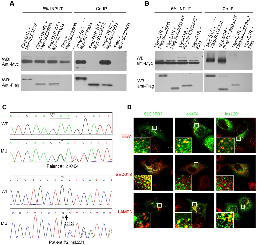 SLC35D3 interacts with D1R and mutations of <i>SLC35D3</i> alter its subcellular distribution.