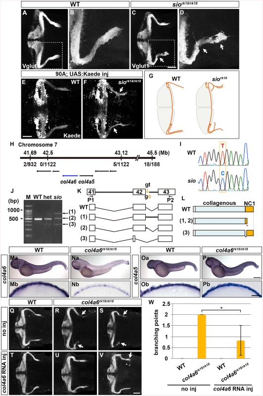 Type IV collagen gene <i>col4a6</i> is required for axogenesis of the GCs in caudolateral lobes.