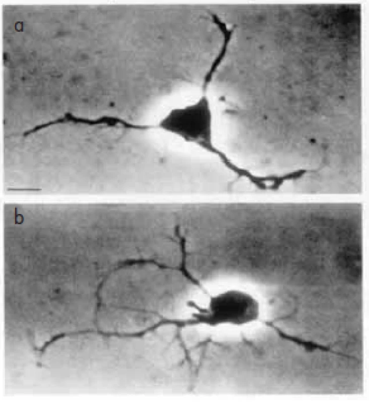růst neuritů; a – v nepřítomnosti estrogenu; b – v přítomnosti estrogenu.