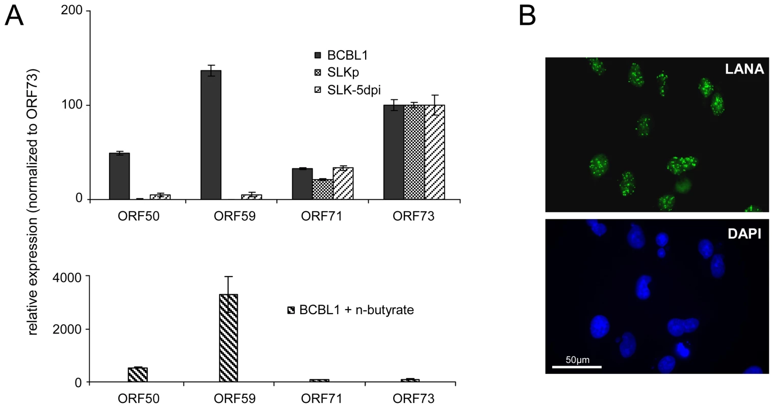 Latent KSHV expression patterns of SLK<i><sub>P</sub></i> and <i>de novo</i> infected SLK cells.