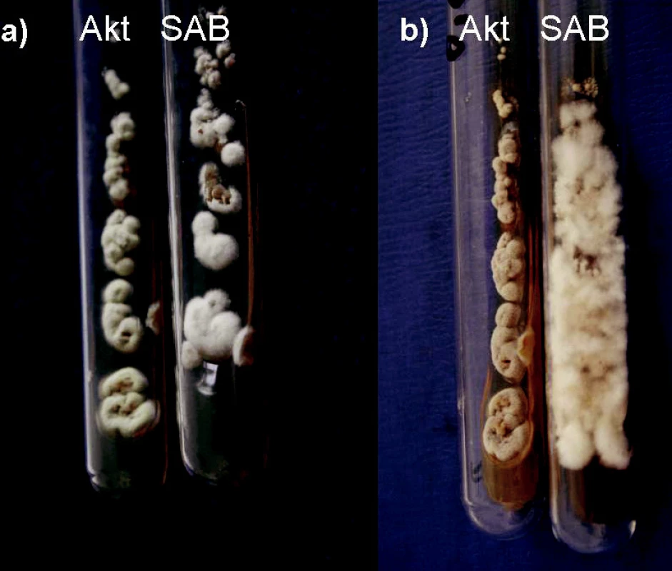 a, b. Onychocola canadensis, primokultúry, masívne rastúce z nechtov pacientky (Akt = agar s aktidionom, SAB = Sabouraudov agar, 25 °C); a) po 4 týždňoch, b) po 11 týždňoch (foto Ing. K. Furdíková)
Fig. 2 a, b. Onychocola canadensis, primocultures, massive growth of the agent from nail specimens (Akt = actidion agar, SAB = Sabouraud agar, 25 °C); a) after 4 weeks b) after 11 weeks (photo K. Furdíková)