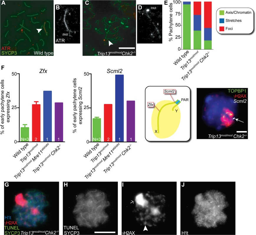 Sex body deficiency in <i>Trip13</i> mutants.