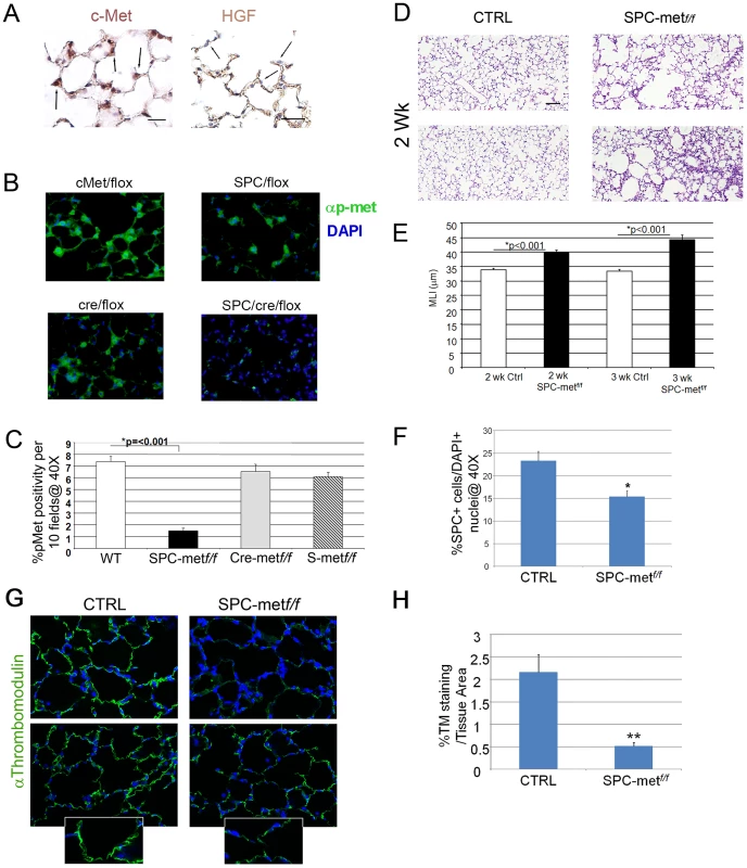 Generation and characterization of mice deficient in <i>Met</i> expression in alveolar epithelial cells.