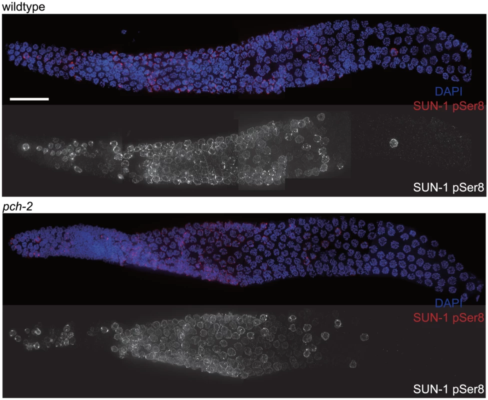 The appearance and disappearance of phosphorylated SUN-1 is not affected by mutation of <i>pch-2</i>.