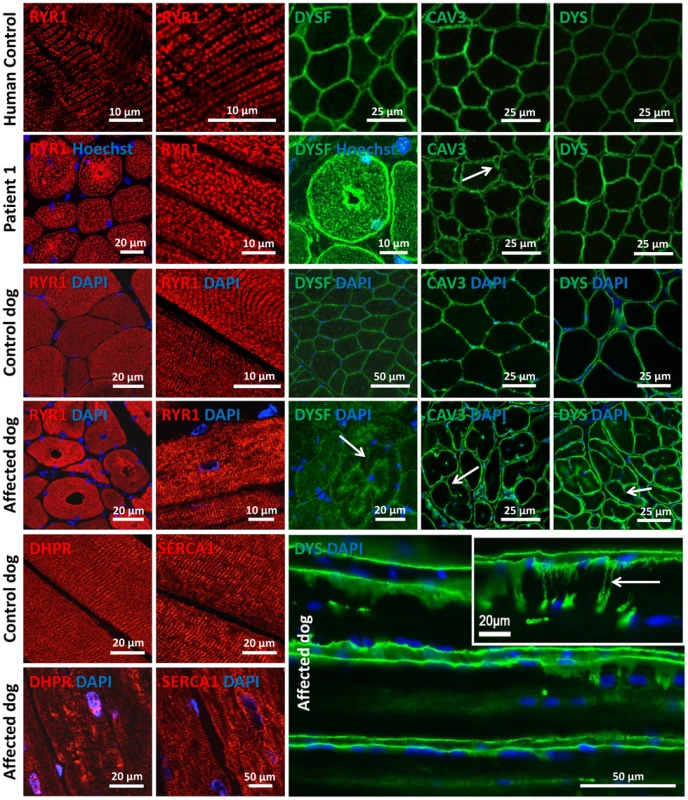 Alteration of triad components and proteins regulating membrane trafficking.