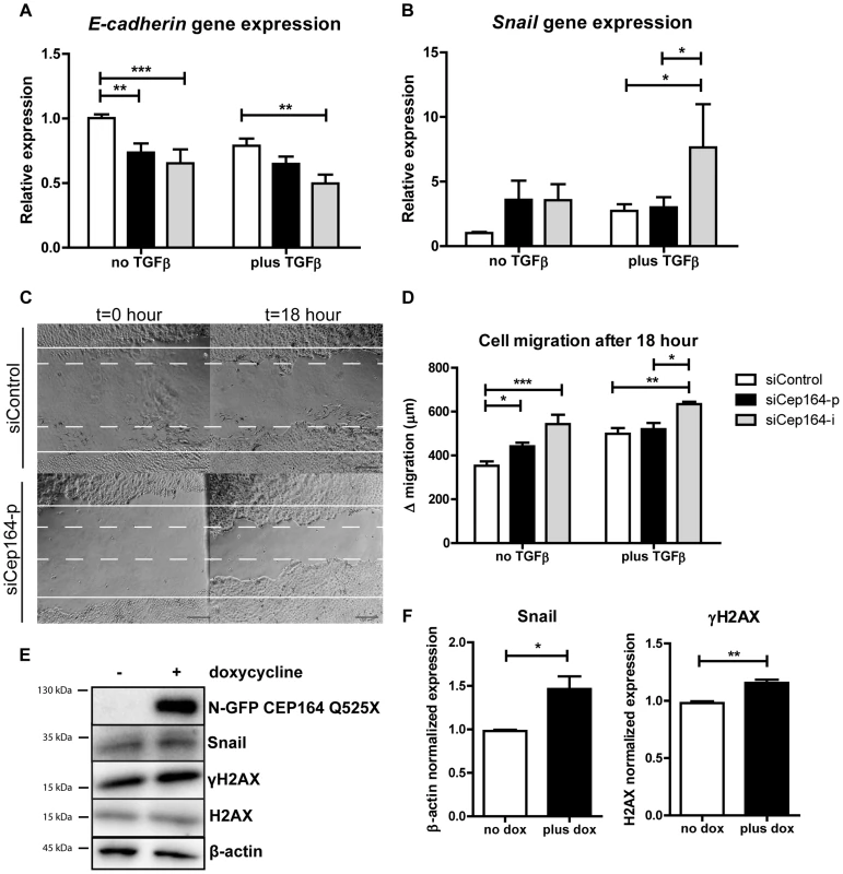 Loss of Cep164 induces EMT.